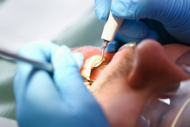 Best Emergency Gum Treatment in Westlake Village, CA